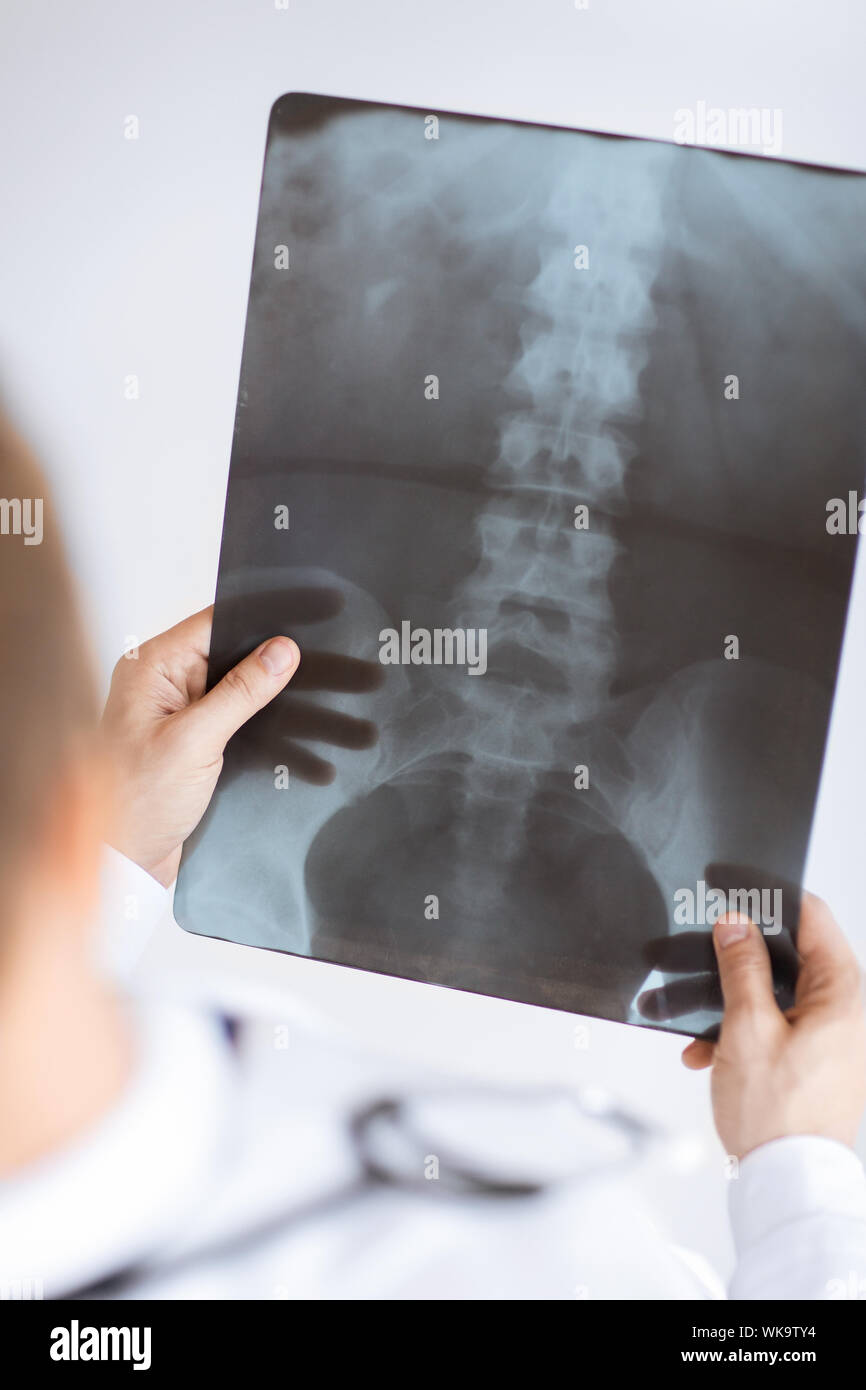 close up of male doctor holding x-ray or roentgen image Stock Photo