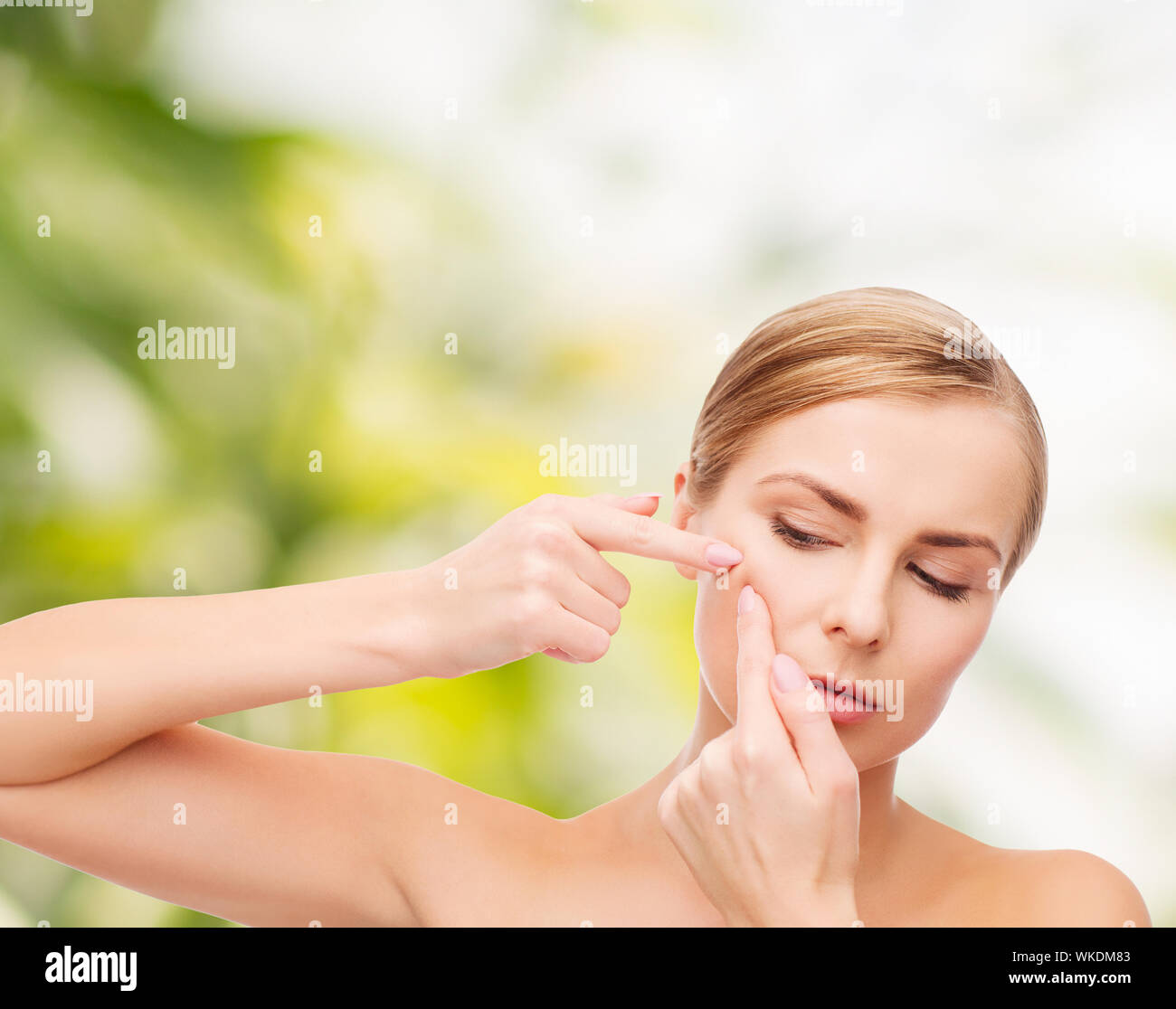 young woman squeezing acne spots Stock Photo Alamy