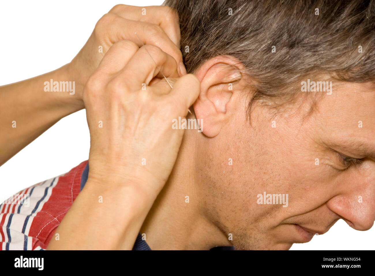 Cropped Image Of Hand Applying Acupuncture Needle On Man Neck Stock Photo