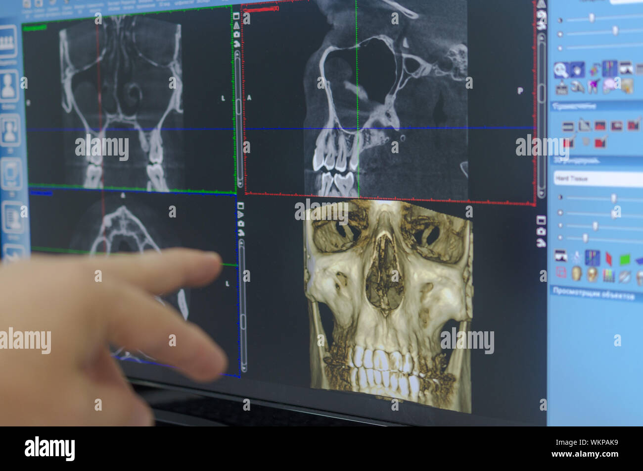 The doctor examines a Xray examination of the maxillofacial region of