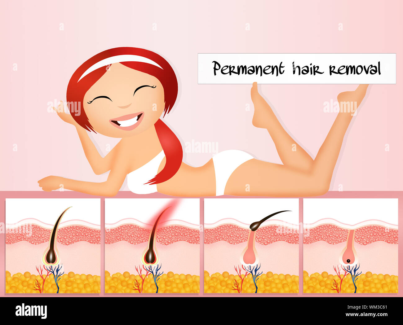 aimanfun hair removal