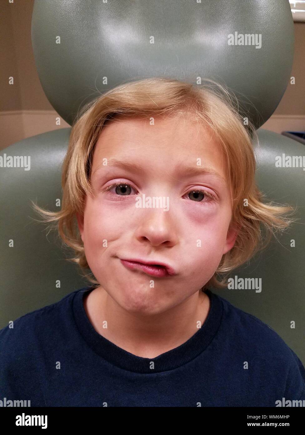 Allergy eyes sore hires stock photography and images Alamy