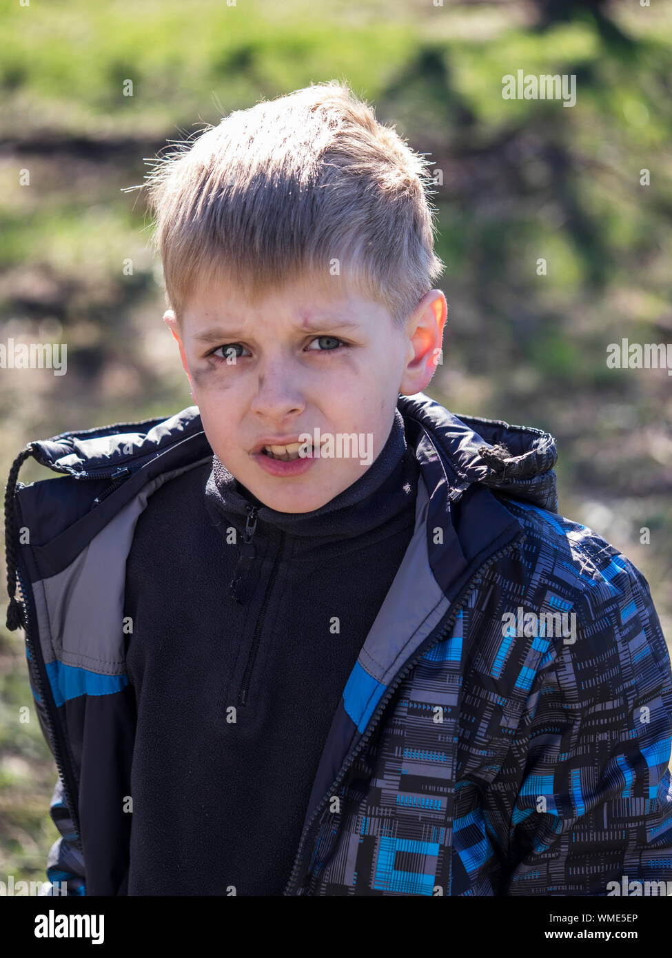 Portrait Of Boy With Soot Smear On Face Stock Photo