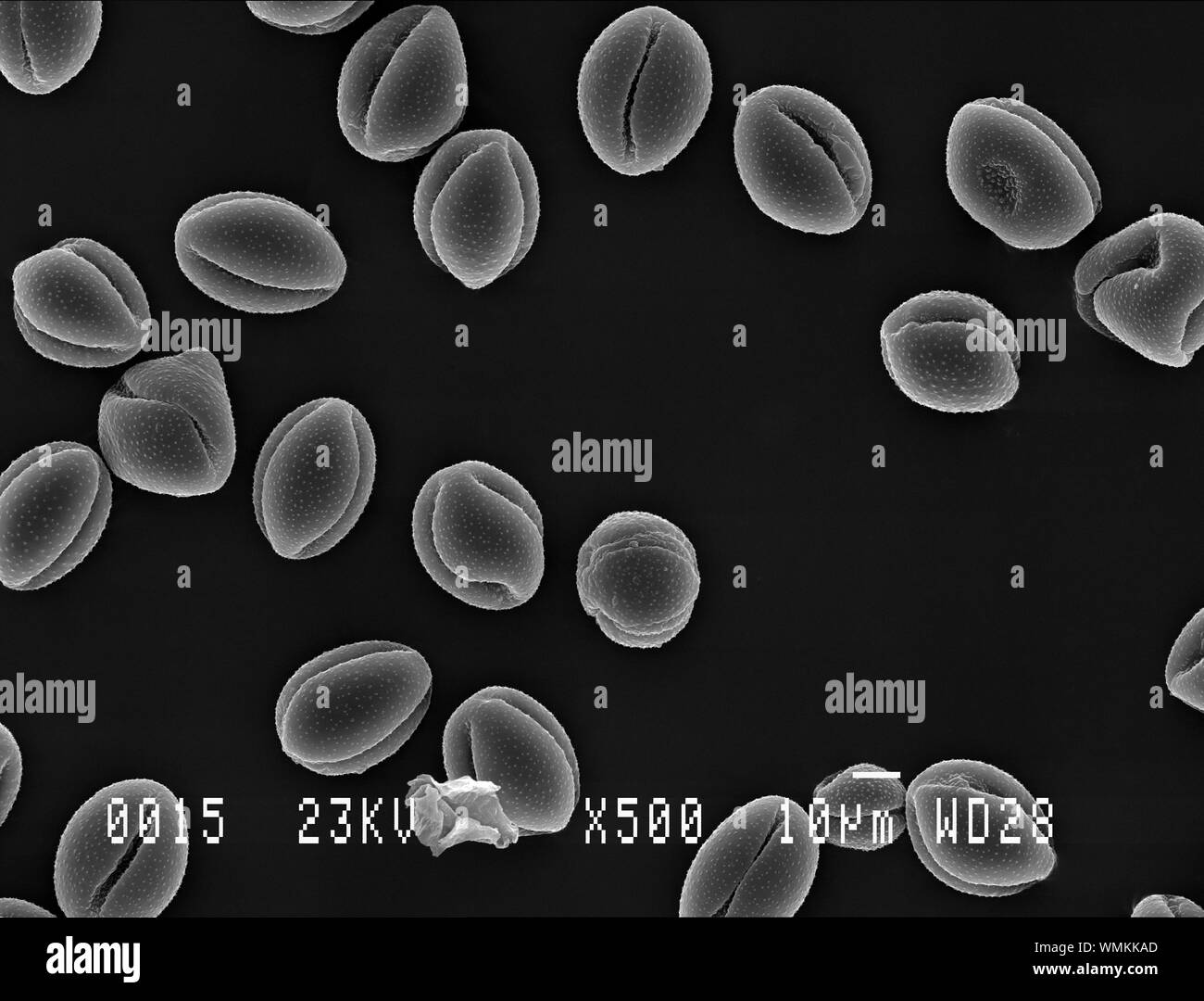 Lesser celandine pollen under electron microscope Stock Photo