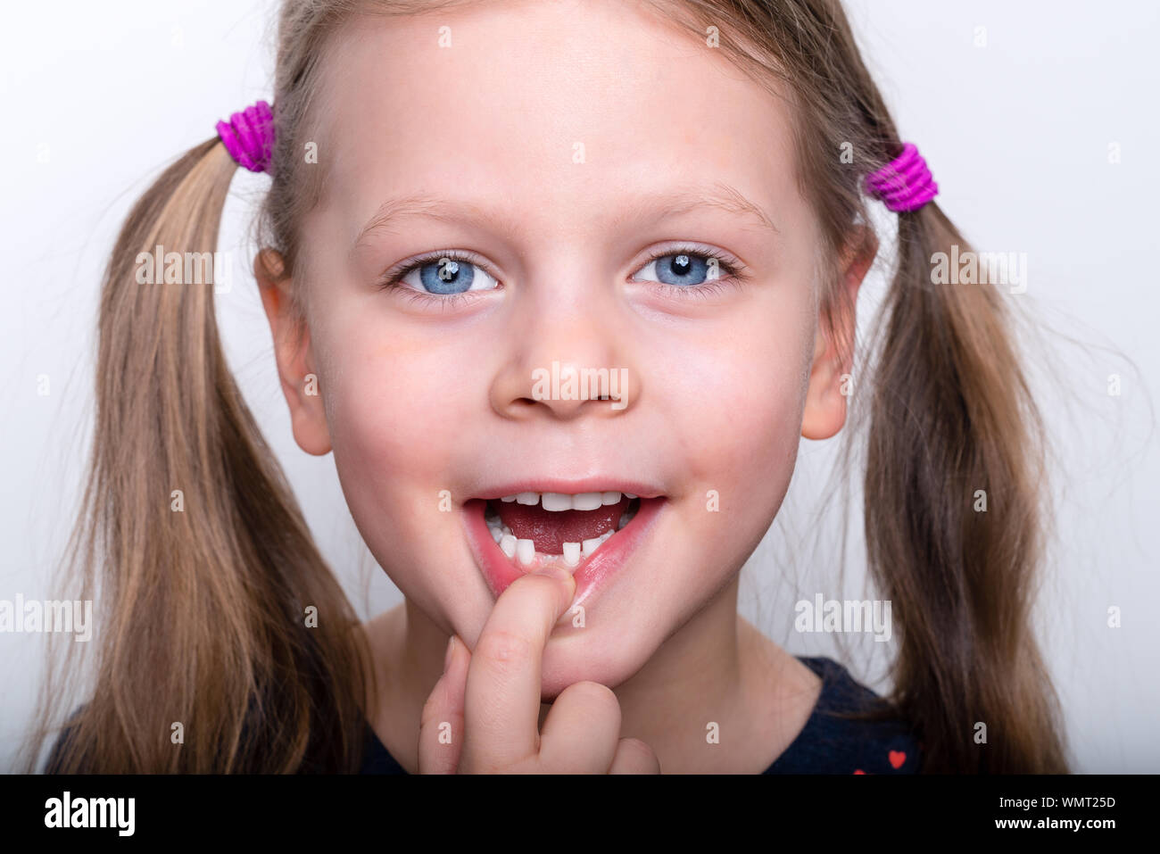 Child girl dropped the first milk tooth preschooler girl with open