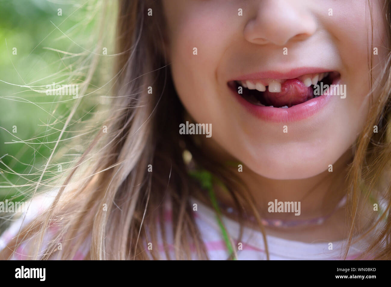 Girl with missing tooth Stock Photo