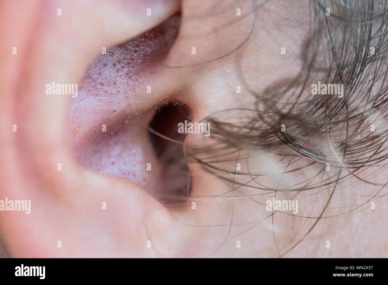 Pores in the ear Stock Photo