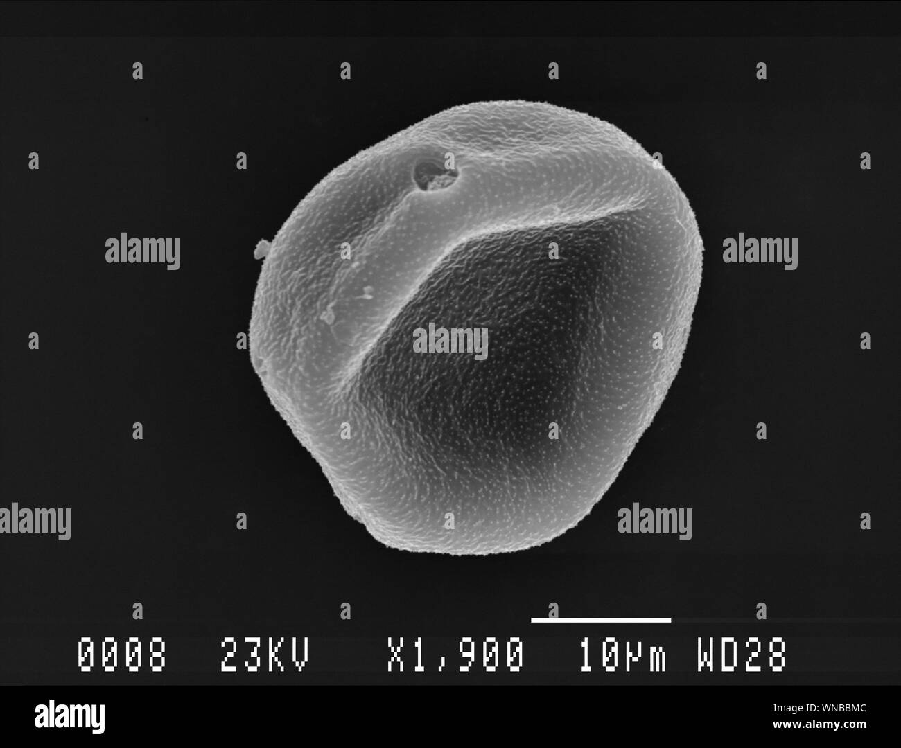 One hornbeam pollen grain scanning electron micrograph Stock Photo