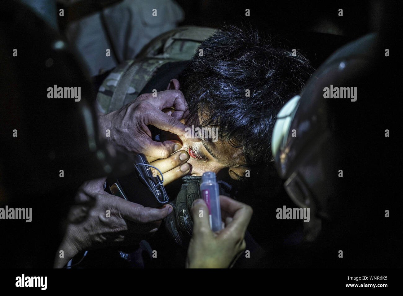 Kowloon, Hong Kong. 6th Sep, 2019. A protester is being treated on his eye by field medic on Friday September 6, 2019in Mong Kok Town Kowloon, Hong Kong.Thousands of protestors gathered outside of Mong Kok police station and around that area to protest the police violence against citizens of Hong Kong.Protesters Moved Nathan Rd to south, destroying surveillance cameras, street signs, building barricades with wooden panes and garbages then set on fire as they move on.9/6/2019.Kowloon, Hong Kong. Credit: ZUMA Press, Inc./Alamy Live News Stock Photo