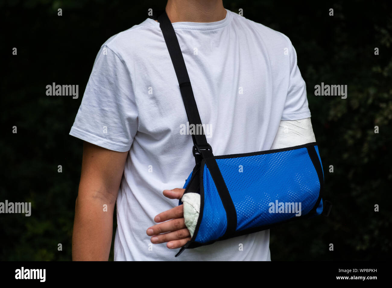 Man with broken arm wrapped medical cast plaster and blue bandage