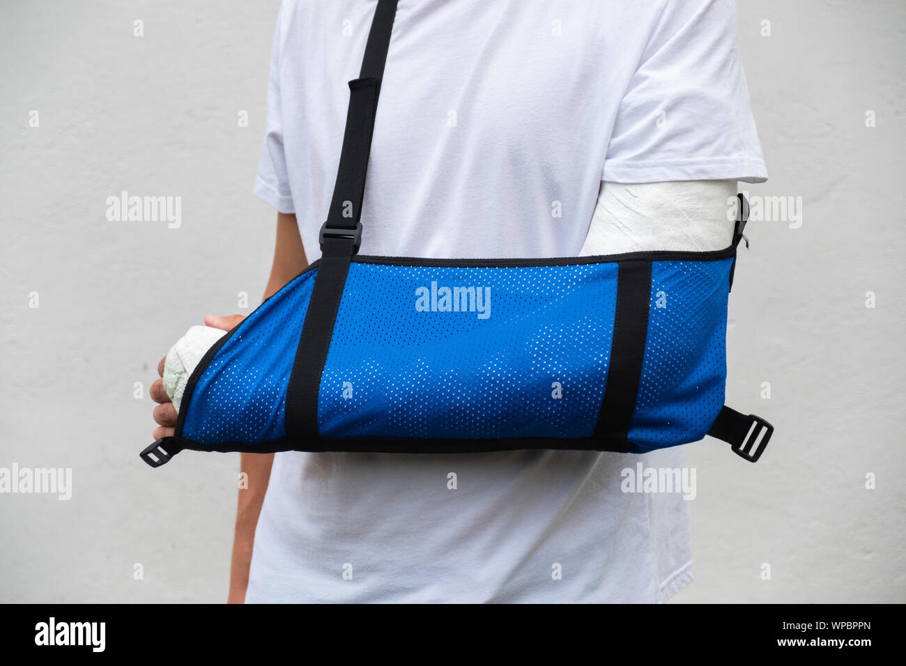 Man with broken arm wrapped medical cast plaster and blue bandage