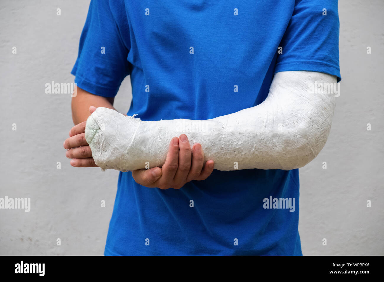 Broken arm cast hi-res stock photography and images - Alamy
