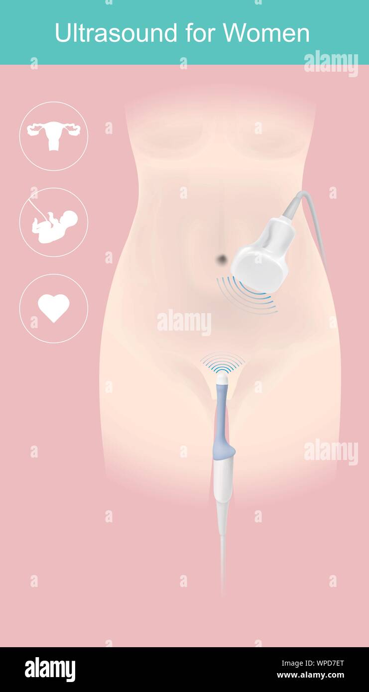 Sample illustrate the medical instrument use into Obstetrician department for women gender examination or Pregnancy, By showing on the computer screen Stock Vector