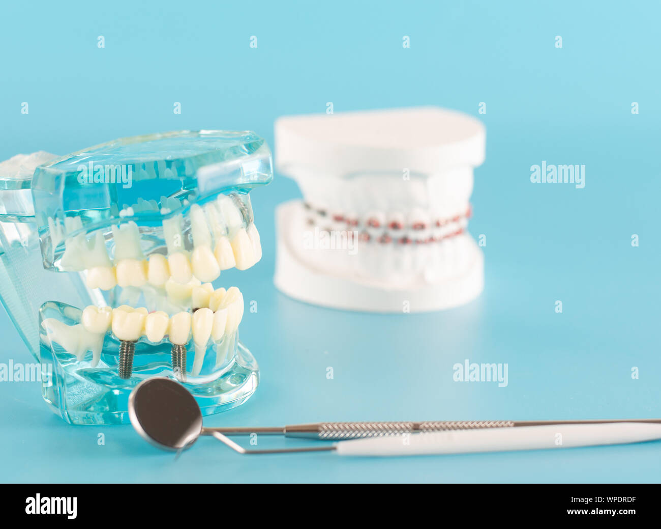Dental implant model on blue background Stock Photo - Alamy