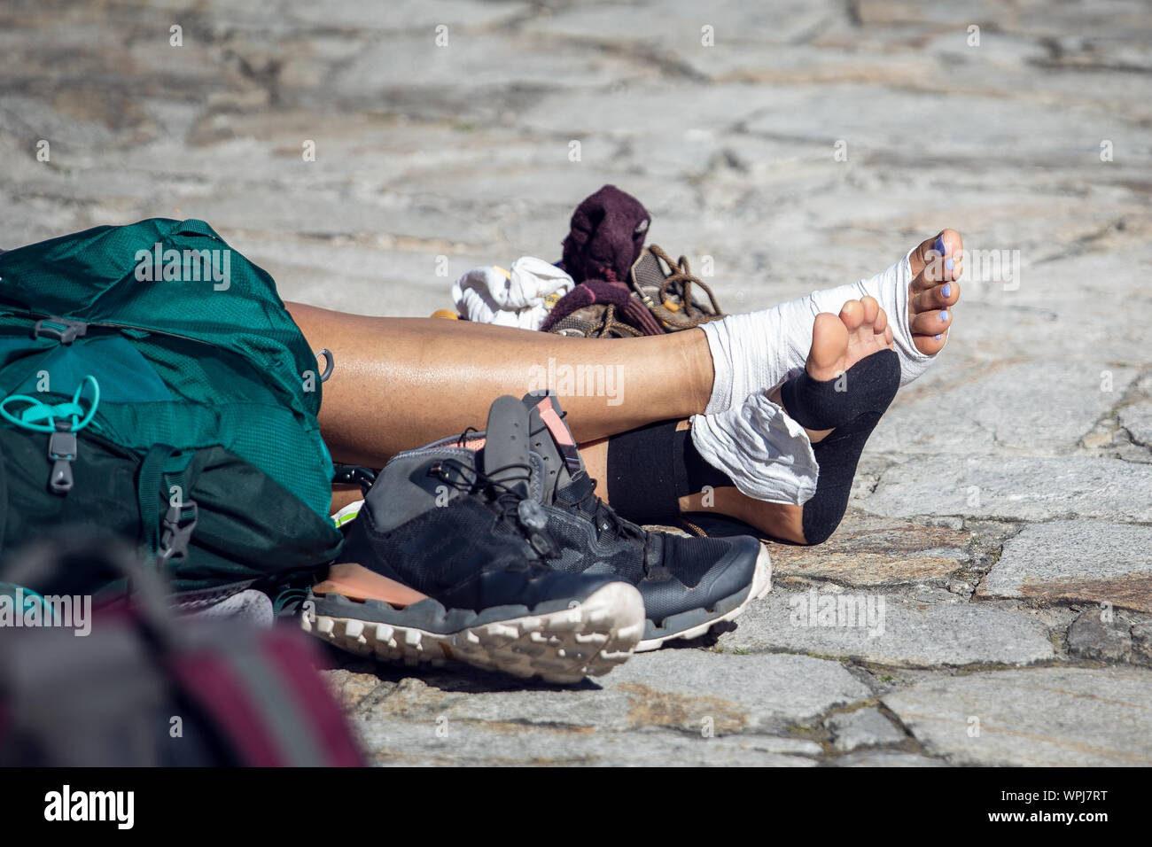 Woman pilgrim legs with injured feet resting on Obradoiro square, Santiago de Compostela, Spain. Copy space Stock Photo