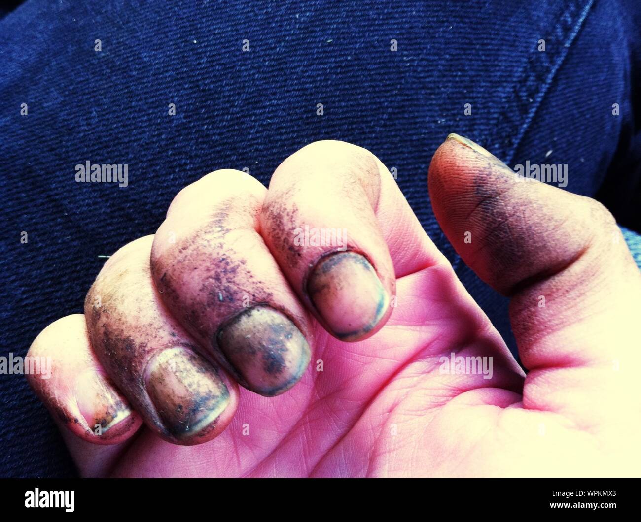 Close Up Of Persons Hand With Dirty Fingernails Stock Photo Alamy