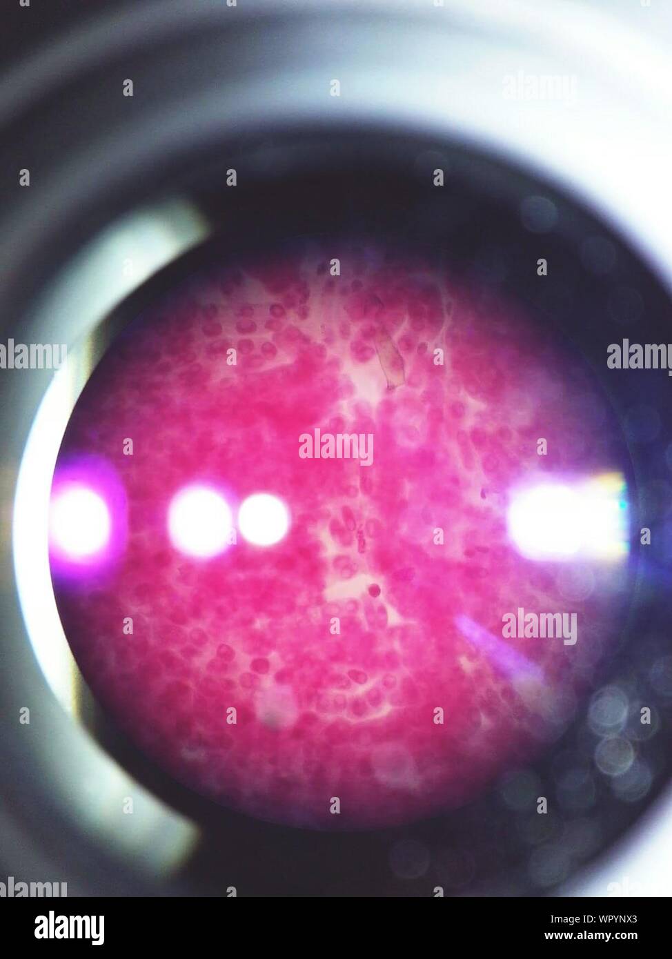 Closeup Of Pink Bacteria Seen Through Microscope Stock Photo Alamy