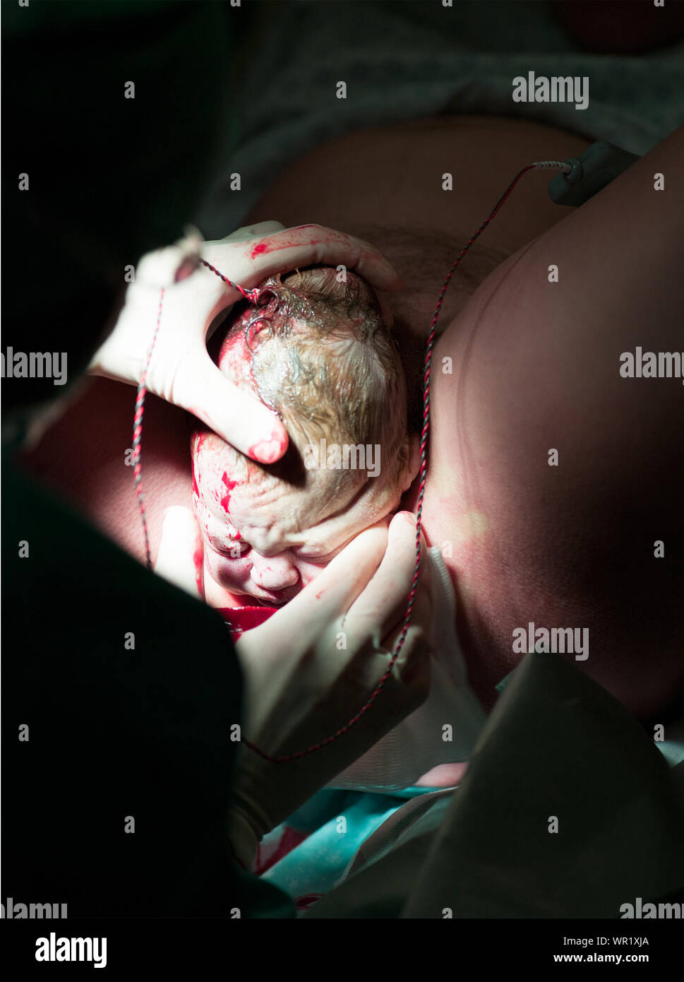 Doctor With Mother Giving Birth To Baby In Hospital Stock Photo