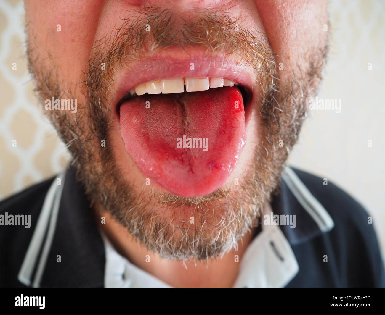 Showing Tongue High Resolution Stock Photography and Images - Alamy