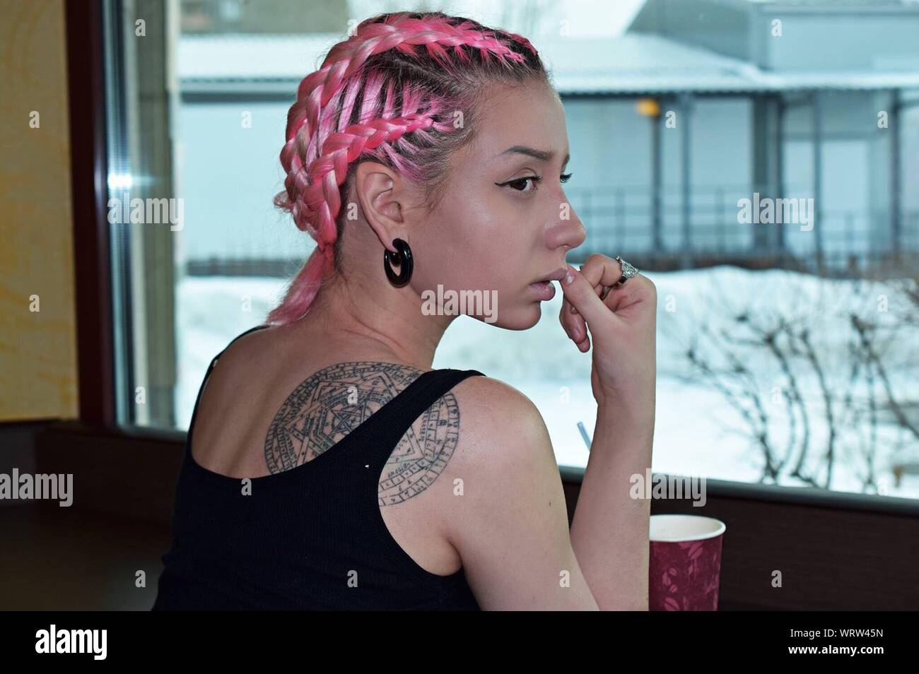 Hair Tattoo  Scalp Micropigmentation in Turkey  Hair Restoration