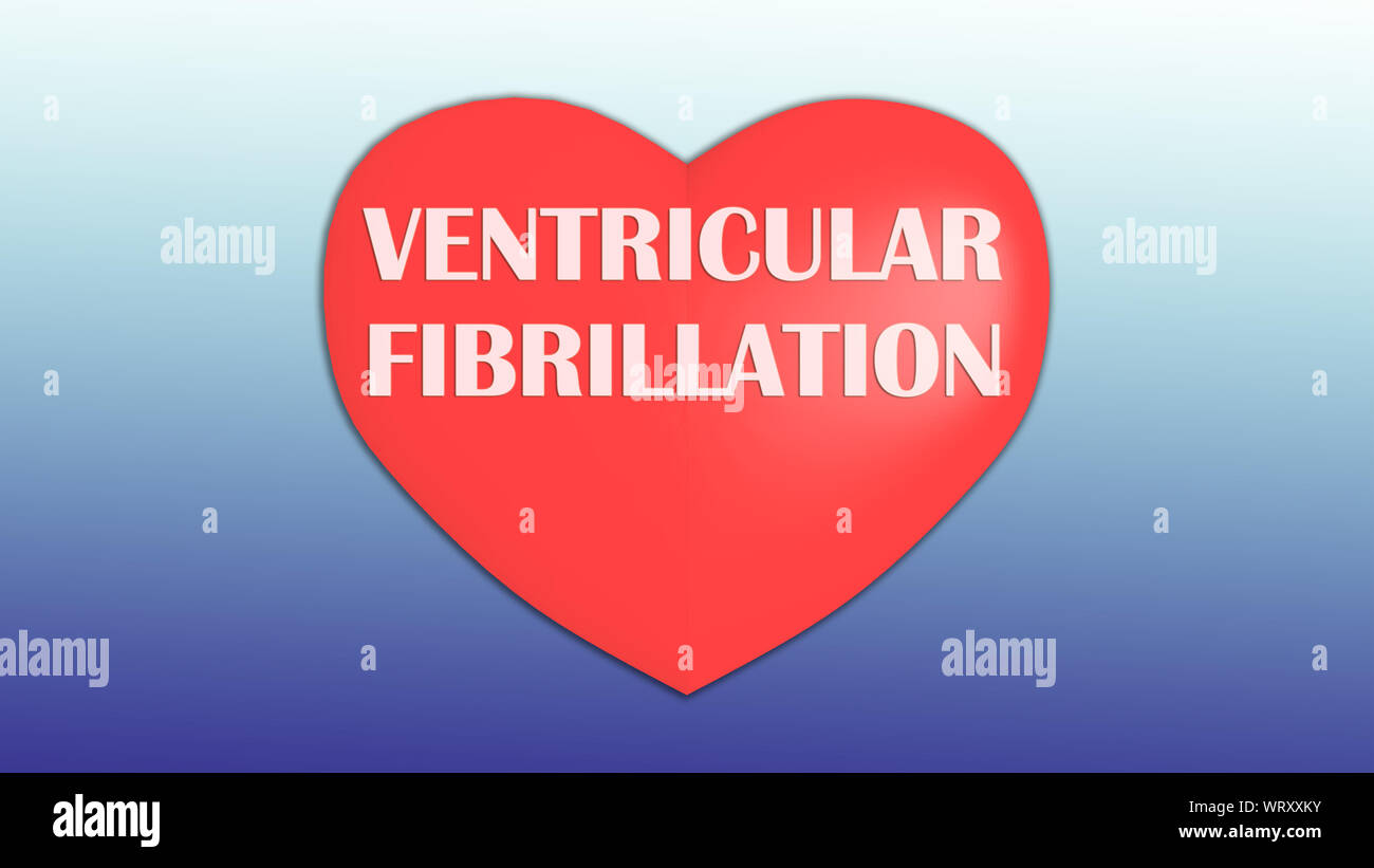 3D illustration of VENTRICULAR FIBRILLATION title on red heart, isolated on blue gradient. Stock Photo