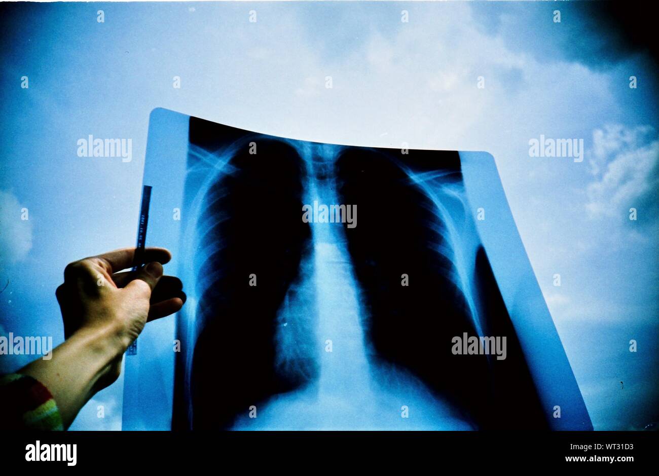 Chest X Ray High Resolution Stock Photography and Images - Alamy