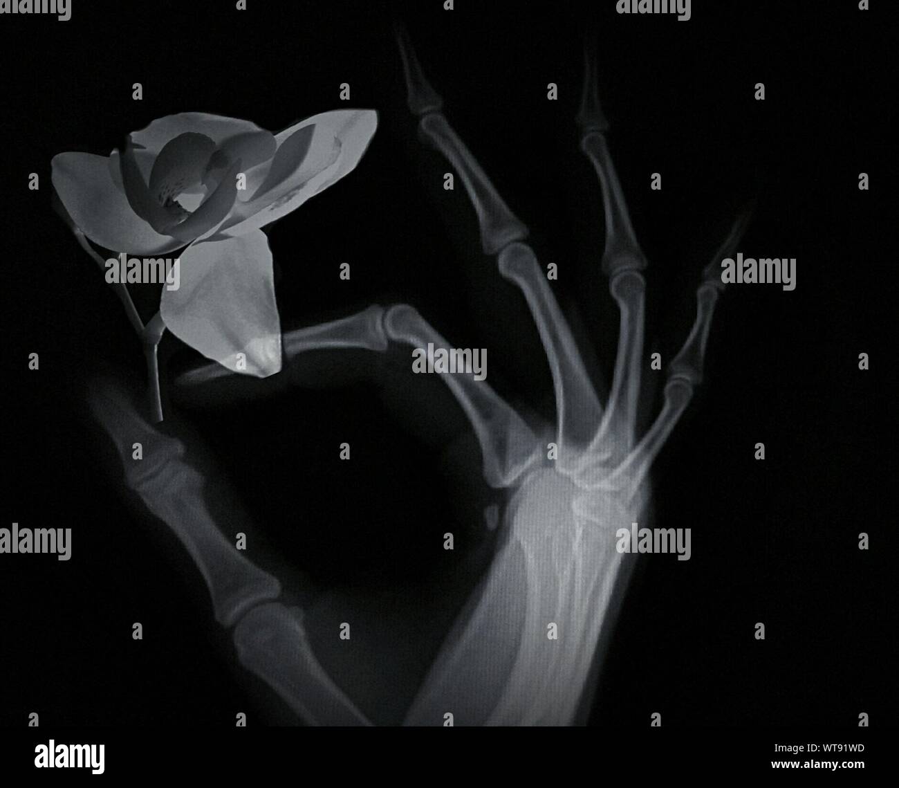 X-ray Image Of Human Hand Holding Single Flower Stock Photo