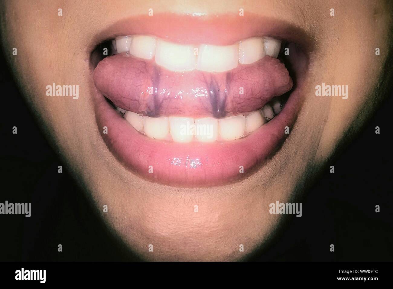 Close-up Of Human Mouth Against Black Background Stock Photo