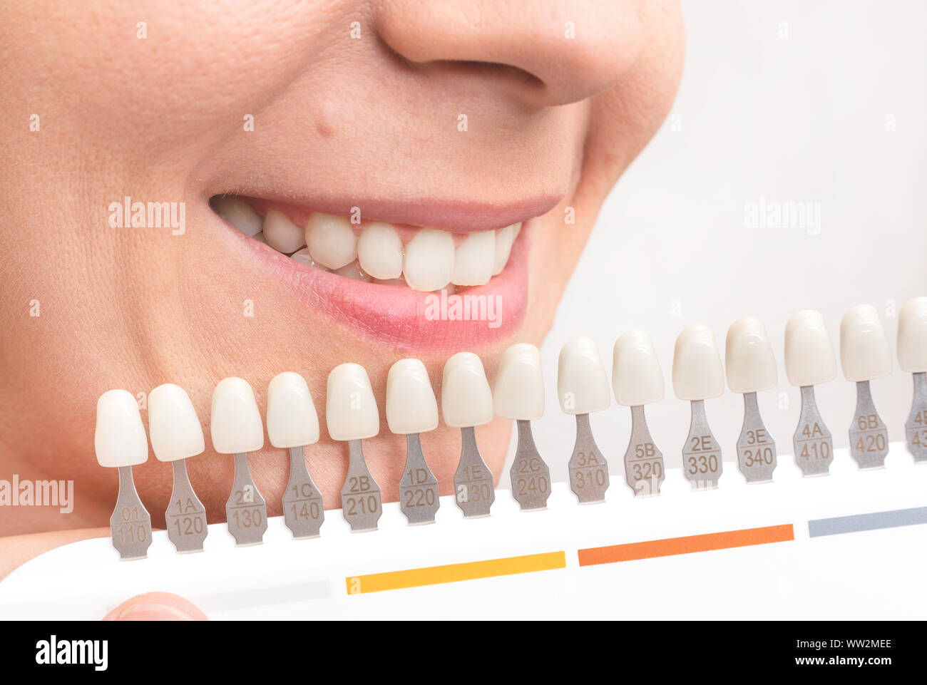 Woman smile with healthy teeth whitening. Dental care concept. Stock Photo