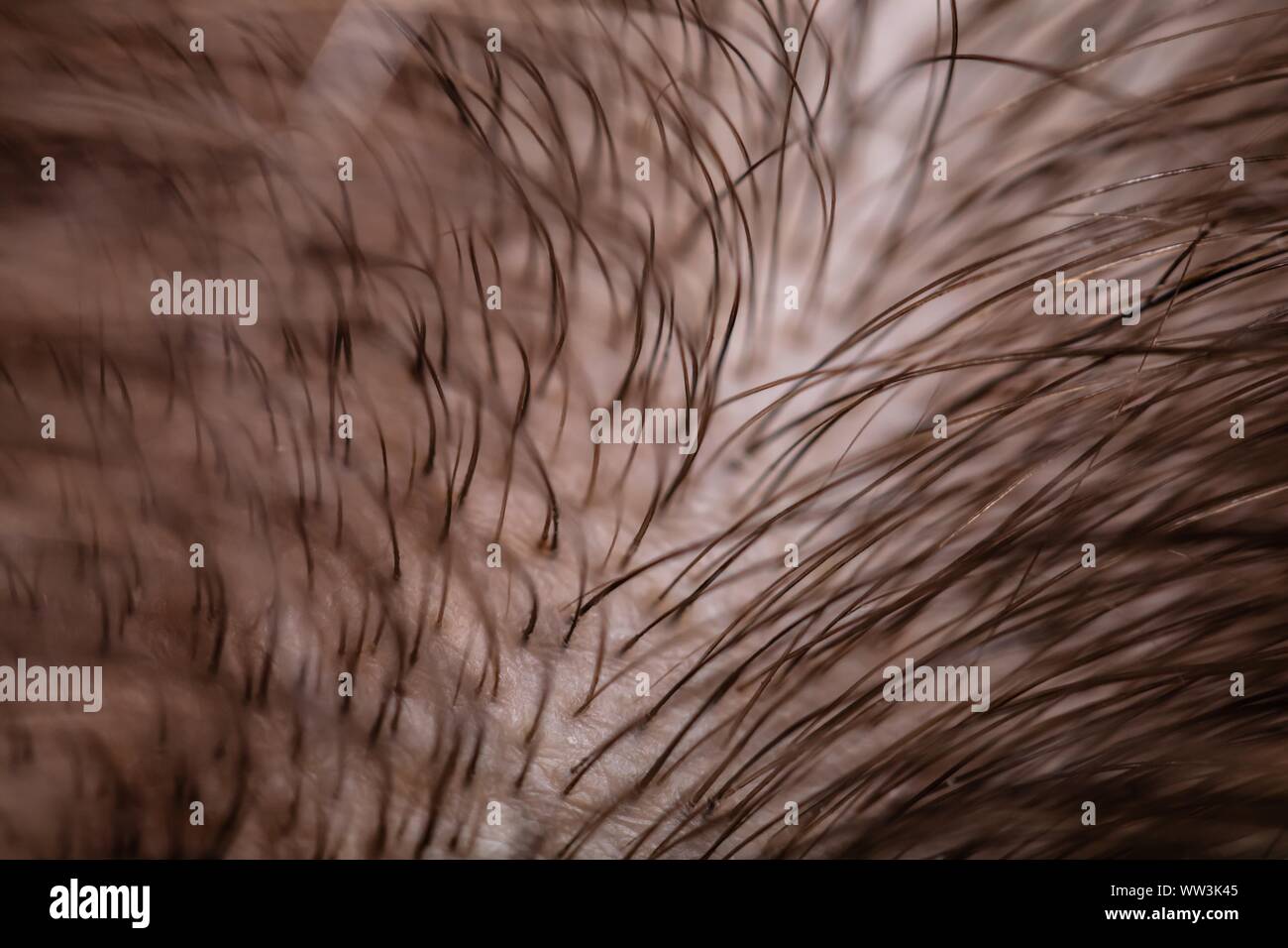 Hair Follicle Macro Stock Photos Hair Follicle Macro Stock