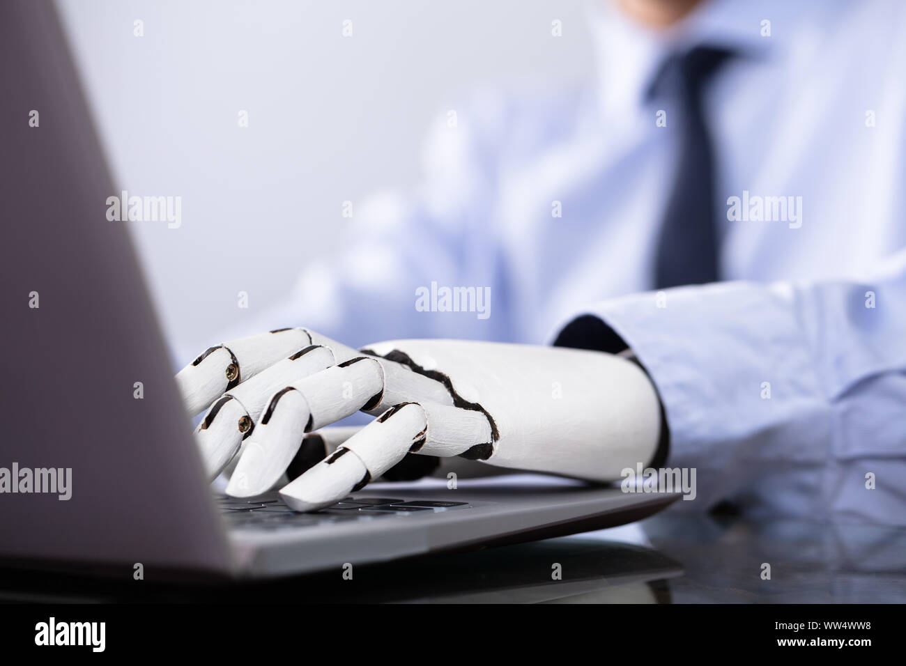 Man With Prosthetic Hand Working On Laptop. Artificial Limb Stock Photo
