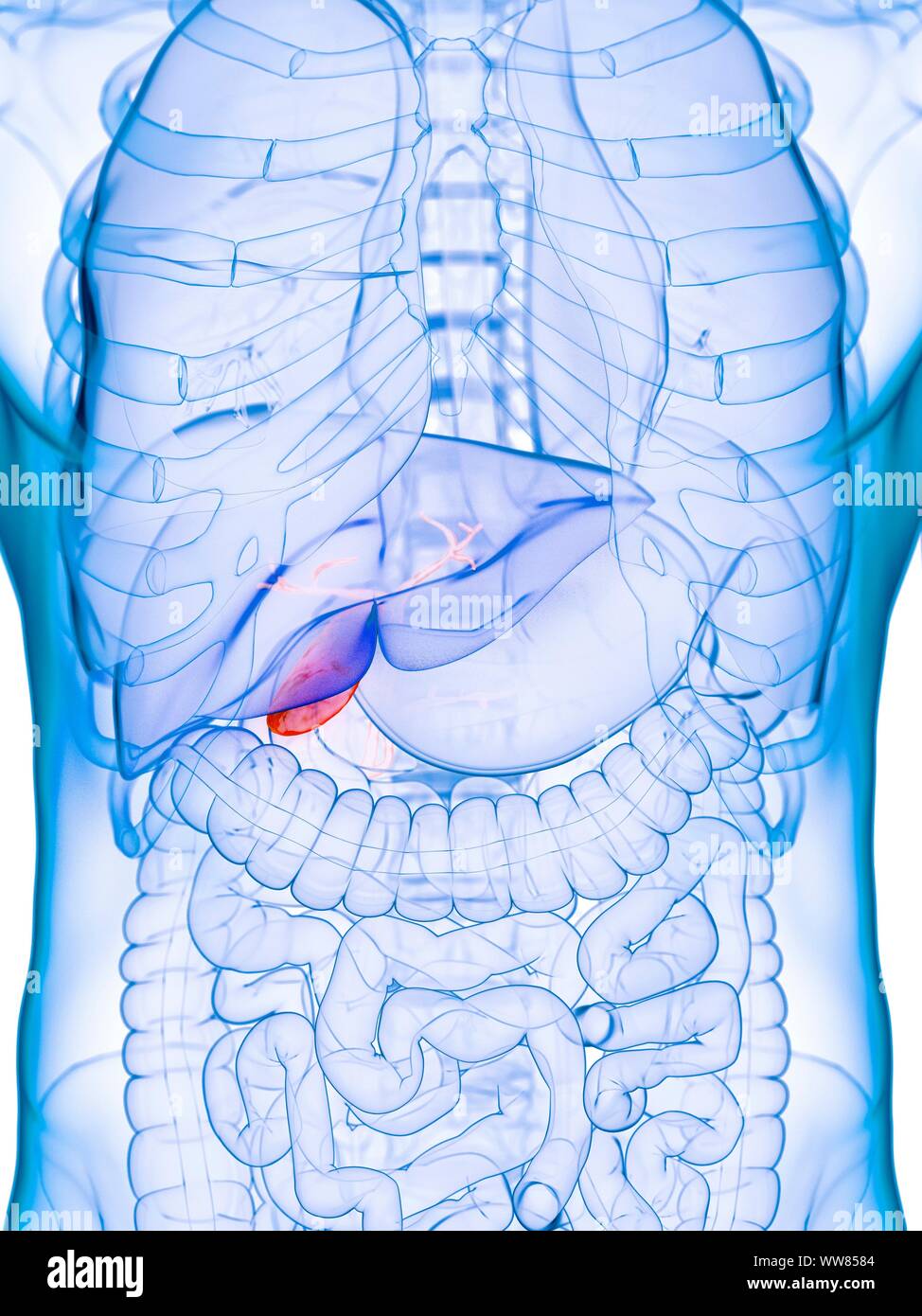 Diseased gallbladder, conceptual illustration Stock Photo