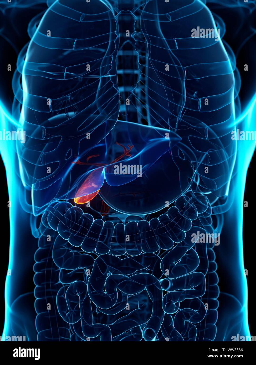 Diseased gallbladder, conceptual illustration Stock Photo