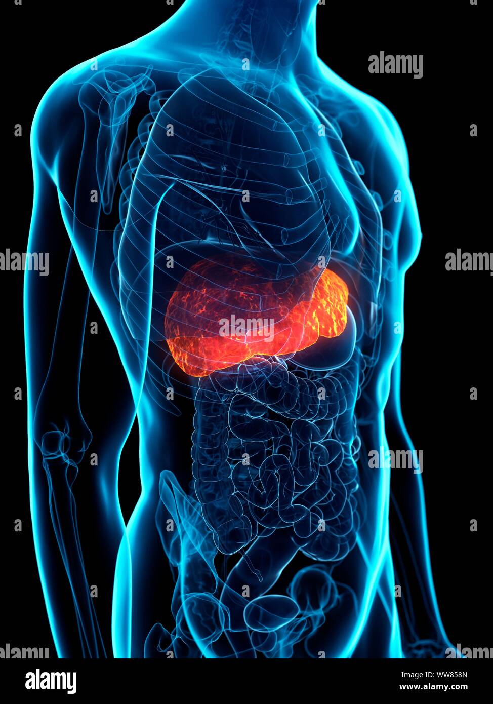 Diseased liver, conceptual illustration Stock Photo - Alamy