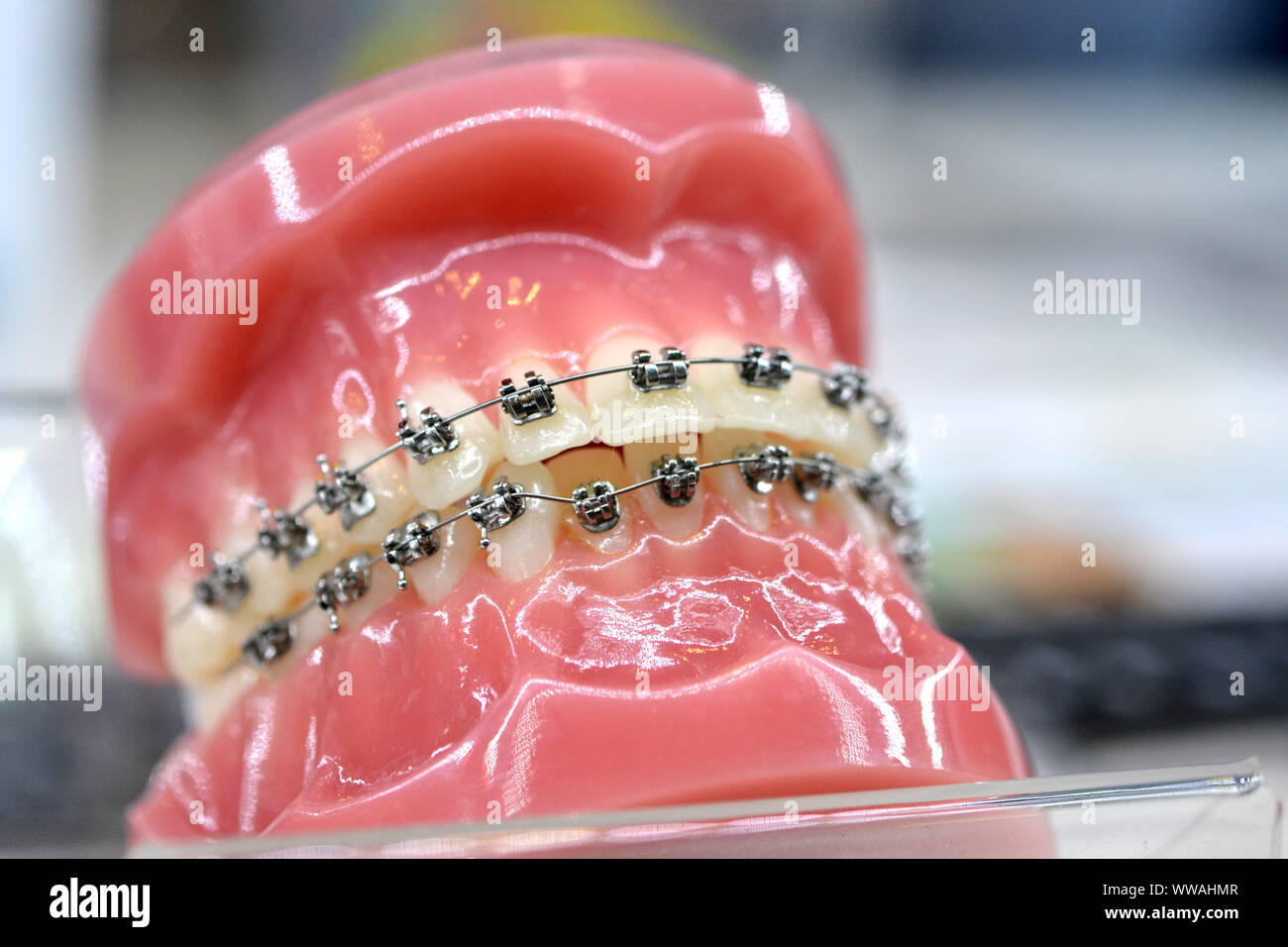 braces on artificial teeth closeup, dental tooth dentistry Stock Photo