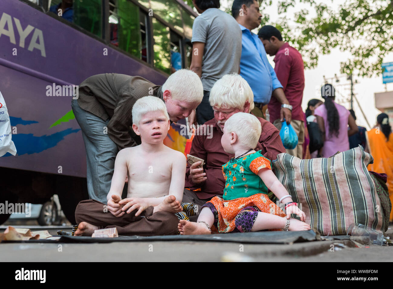Mangalore, Karnataka, India: Indian albino family begs for money in the street. Stock Photo