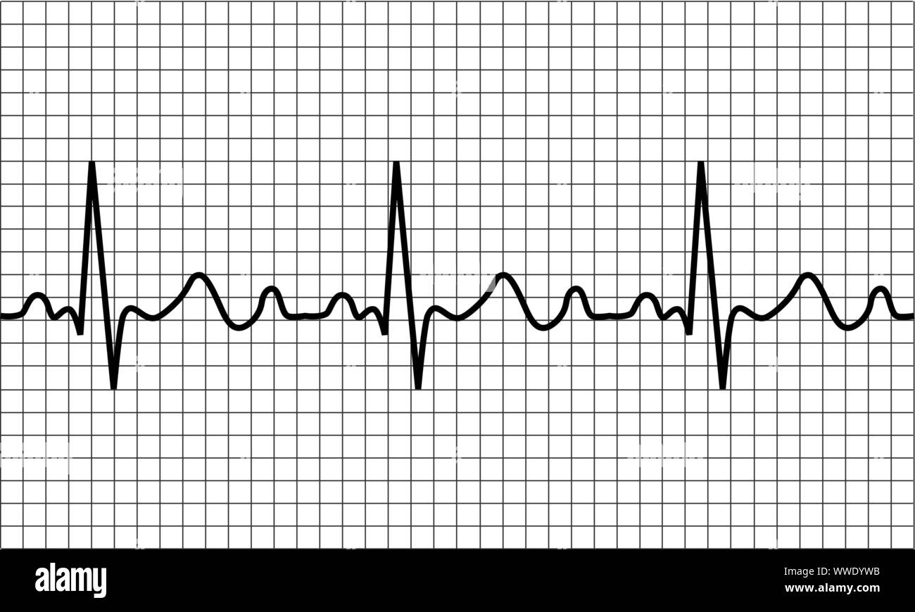 heartbeat icon. ECG Pathology Trace, Vector illustration Stock Vector