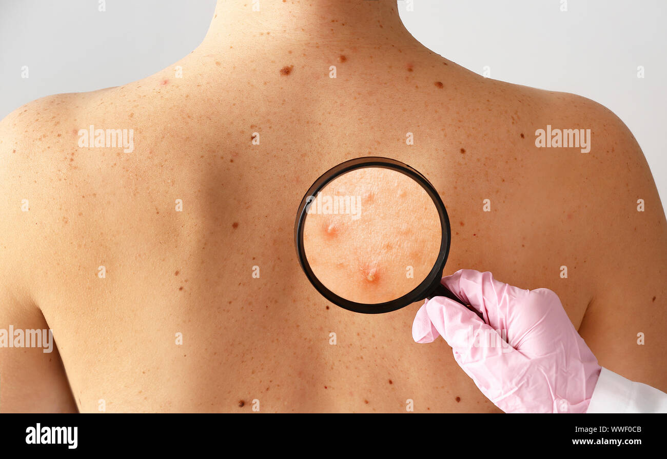 Woman looking through magnifier hi-res stock photography and images - Alamy