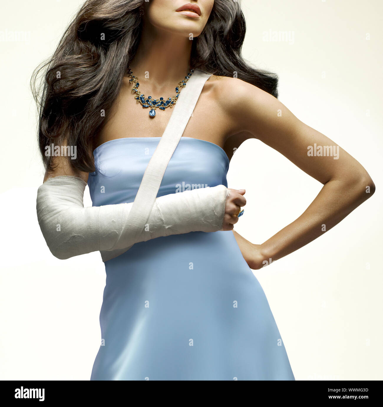 beautiful woman who had broken her arm Stock Photo Alamy