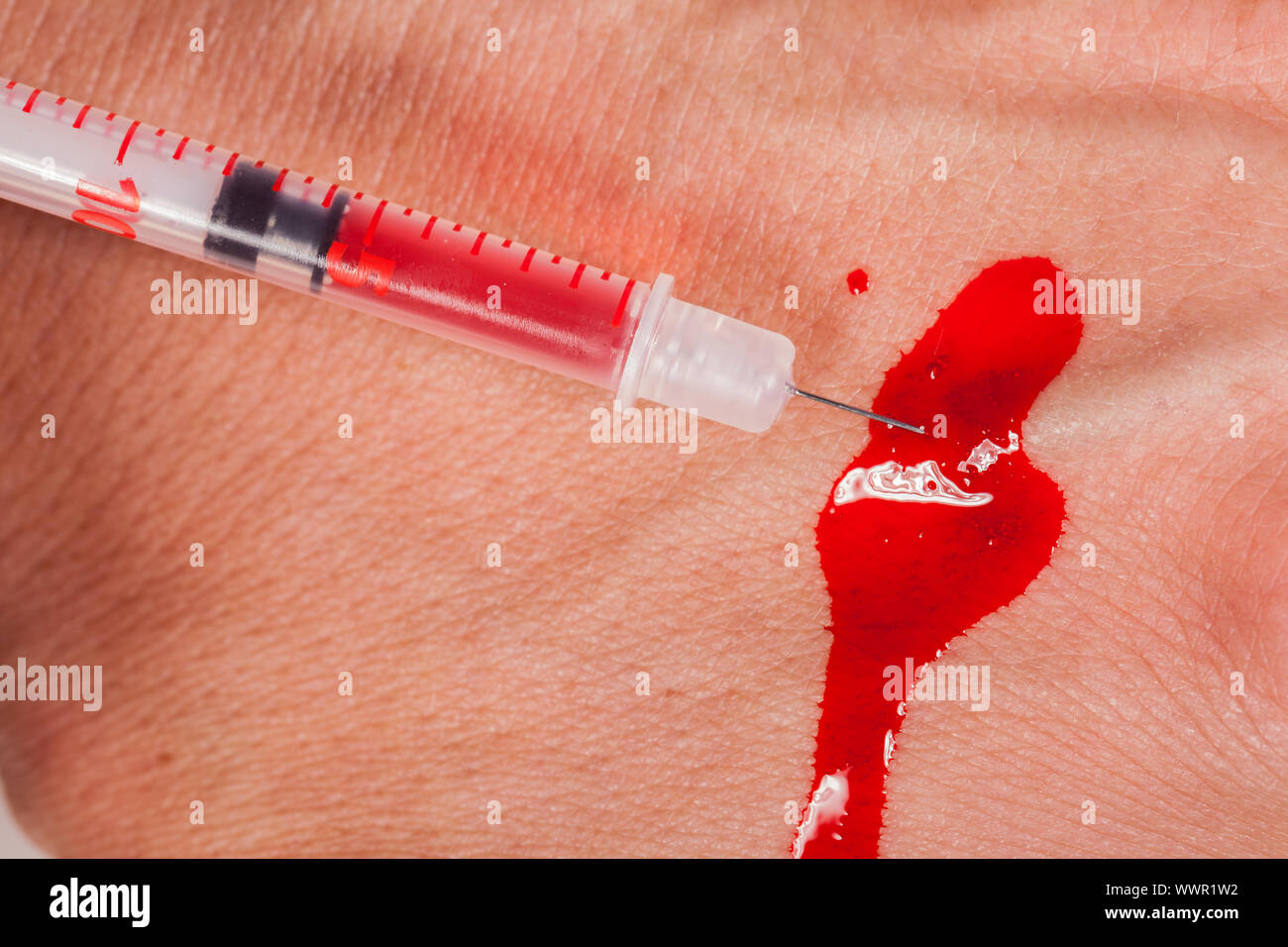 Subcutaneous medical injection concept Stock Photo