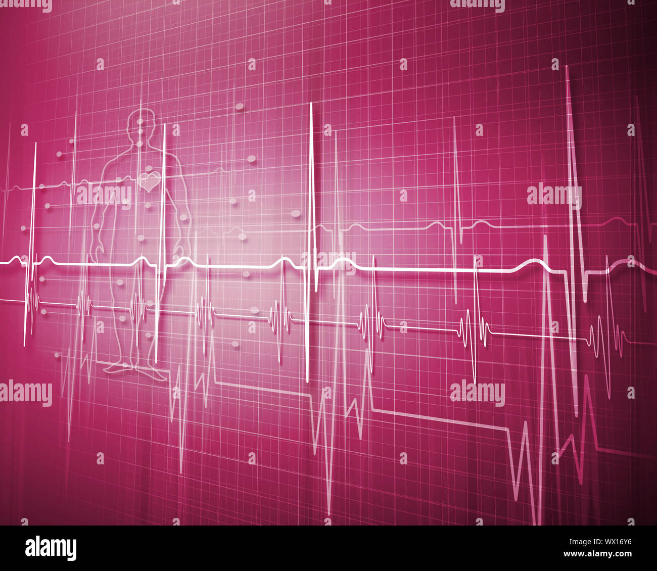 Ecg Monitor Death High Resolution Stock Photography and Images Alamy