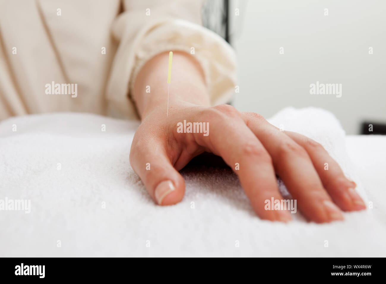 Acupuncture needle in LI4 (large intestine 4) point Stock Photo Alamy