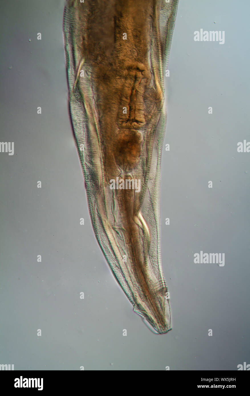 Oxiuris parasitic pinworm 100x Stock Photo