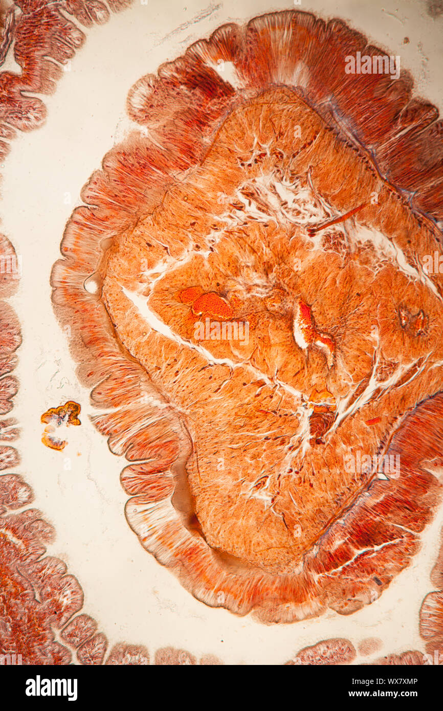 Earthworm cross section 100x Stock Photo