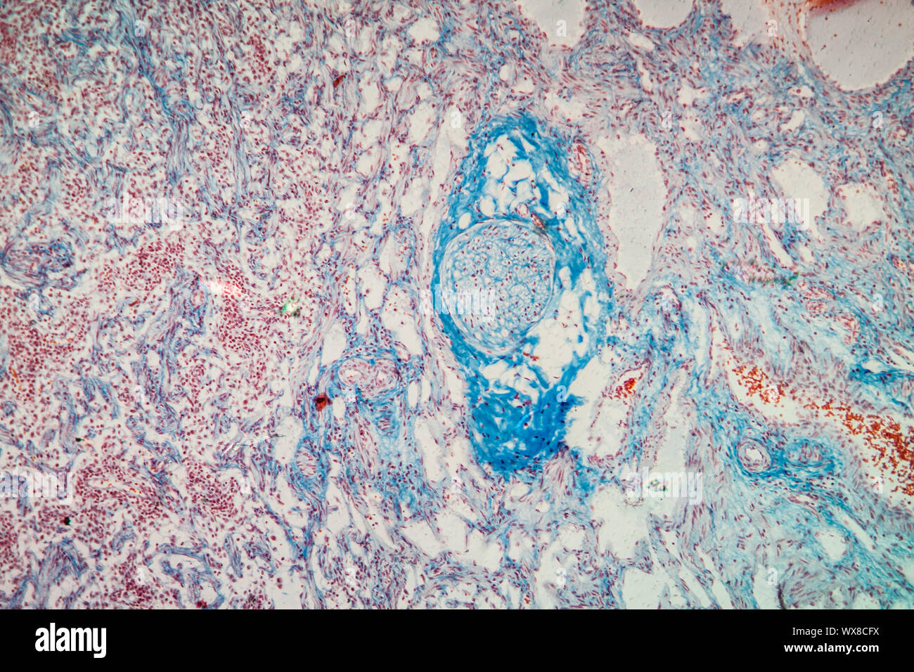 Lymph node tissue under the microscope 100x Stock Photo