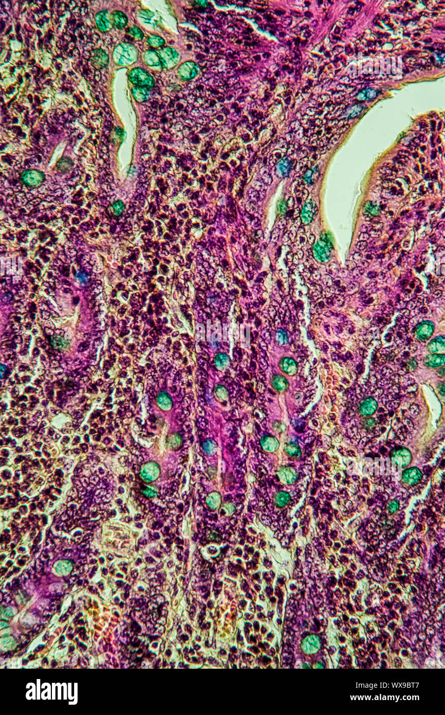 Cross section of small intestine hires stock photography and images