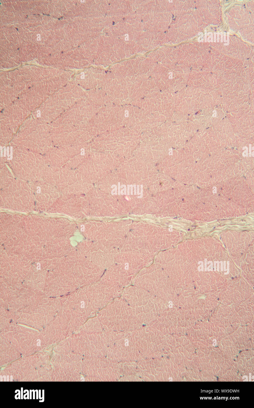 Pigskin skin under the microscope 100x Stock Photo