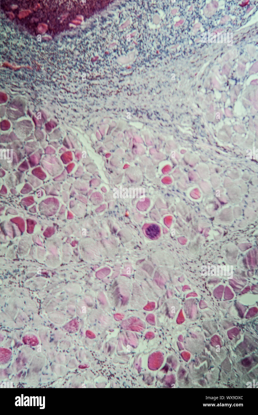 Sarcocystis in cattle spurs in muscle, 100x Stock Photo Alamy