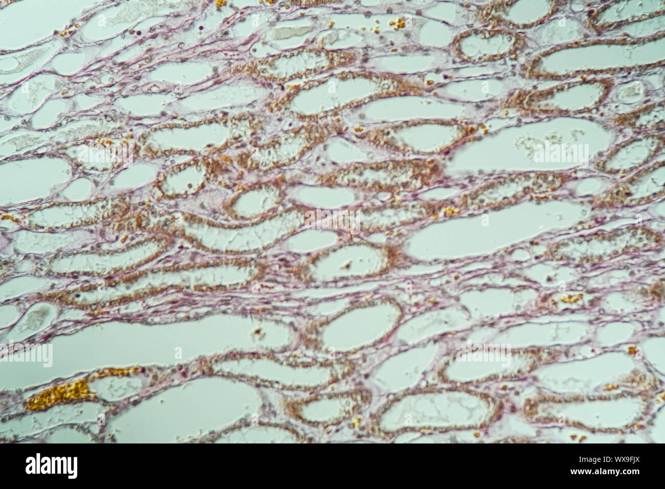 Lungs dog healthy lung tissue 200x Stock Photo - Alamy - Dog Lung Injury From Fabric Threads