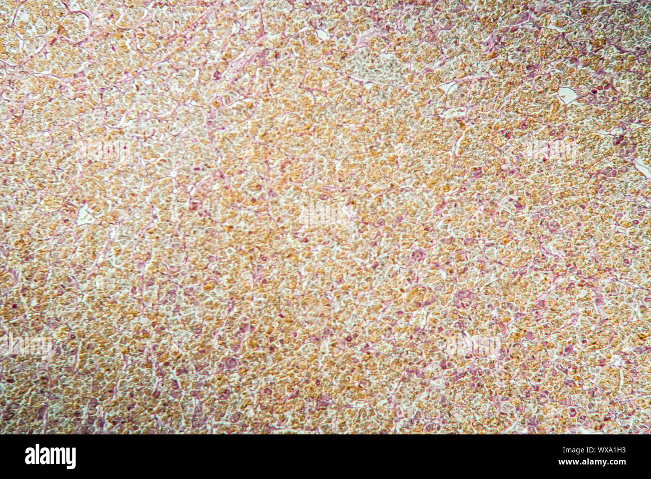 Pituitary pituitary gland under the microscope 100x Stock Photo